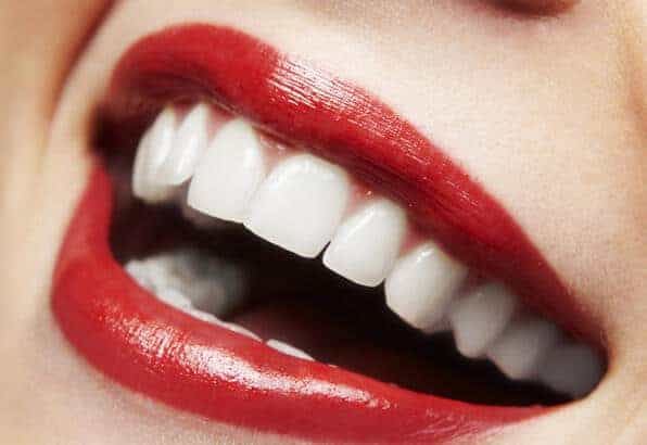 Diş Estetiği Nedir? Nasıl Yapılır? • Antalya Diş Kliniği