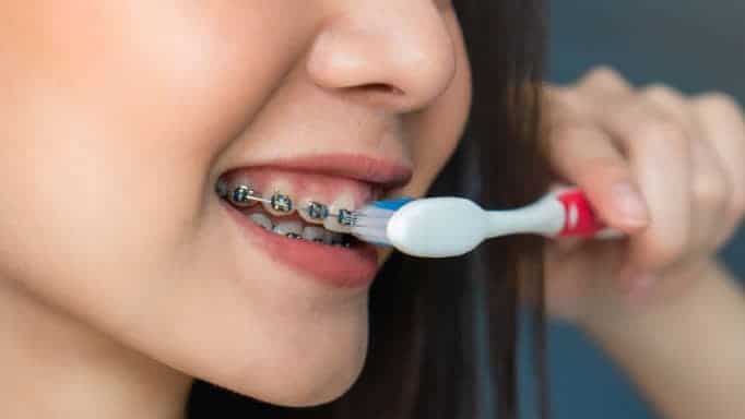 diş teli tedavisi sonrası ağız bakımı