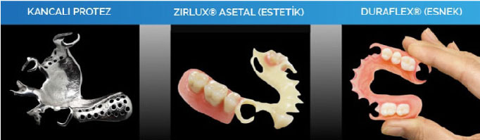 hareketli - kancalı protez diş çeşitleri