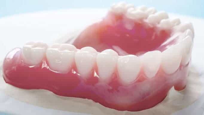 protez diş nedir