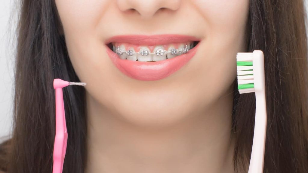 Ortodontik Diş Teli Fırçası