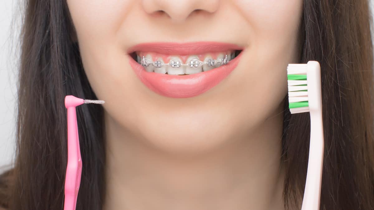 Ortodontik Fırça Seçimi ve Diş Teli Bakımı ve Temizliği Nasıl Yapılır?