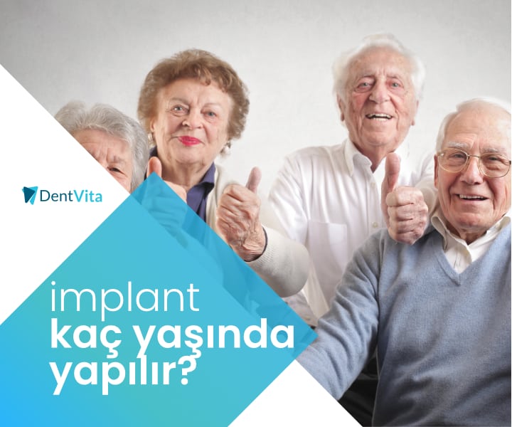 genç yaşta implant en erken kaç yaşında yapılır