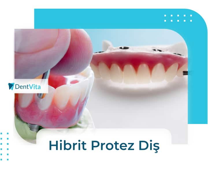 hibrit protez diş